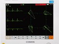 Сердечно-сосудистый монитор COMEN WQ-004